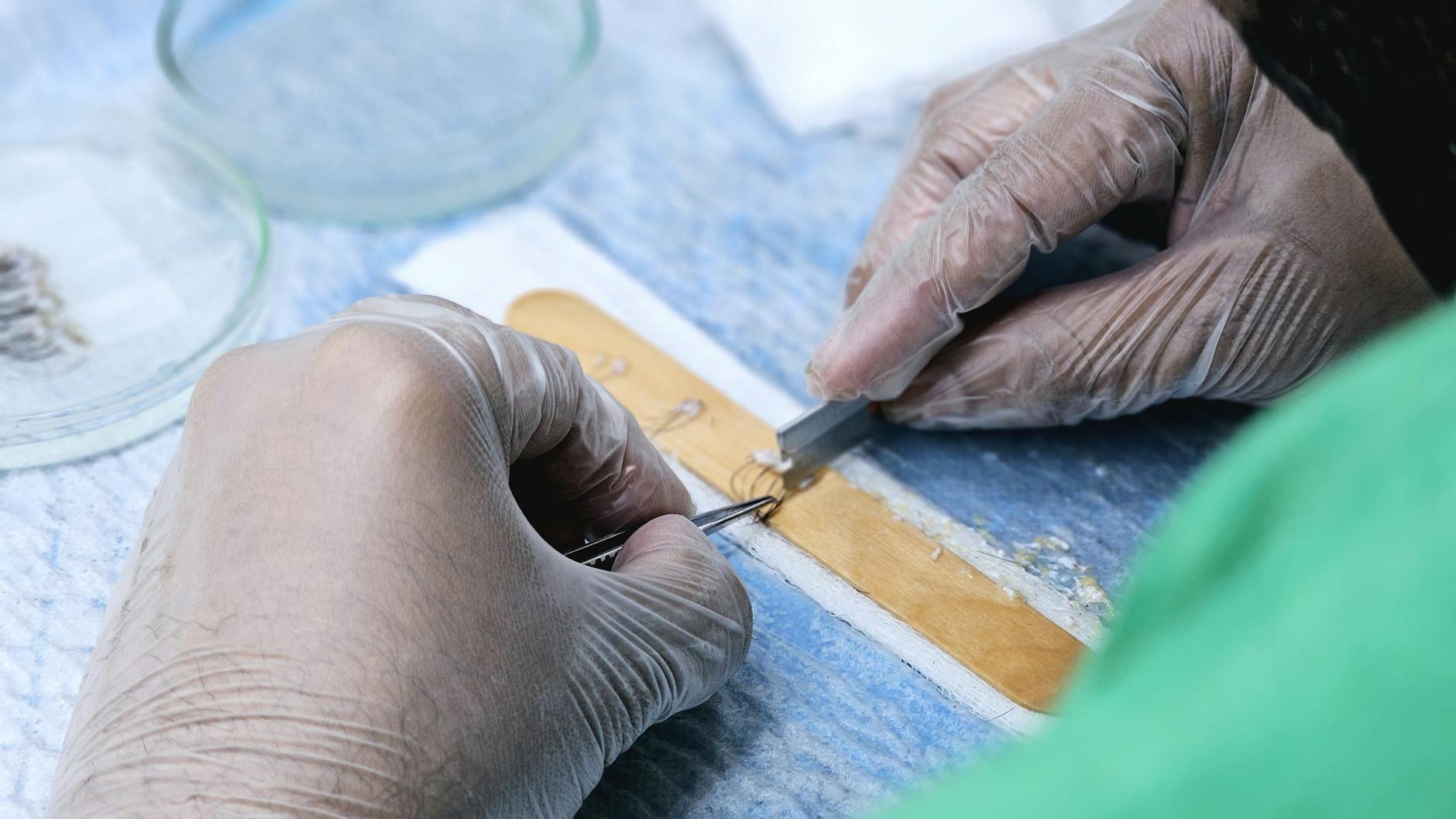 Terapia Regenerativa Capilar en Clínica Gottardo